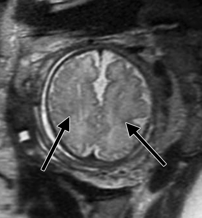 Figure 3b: