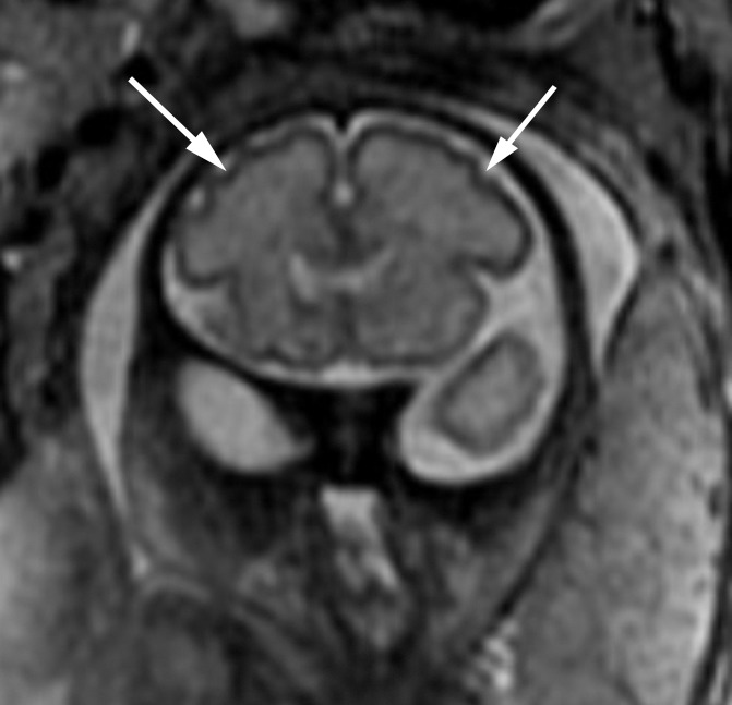 Figure 5b: