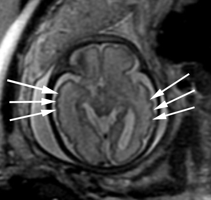 Figure 5c: