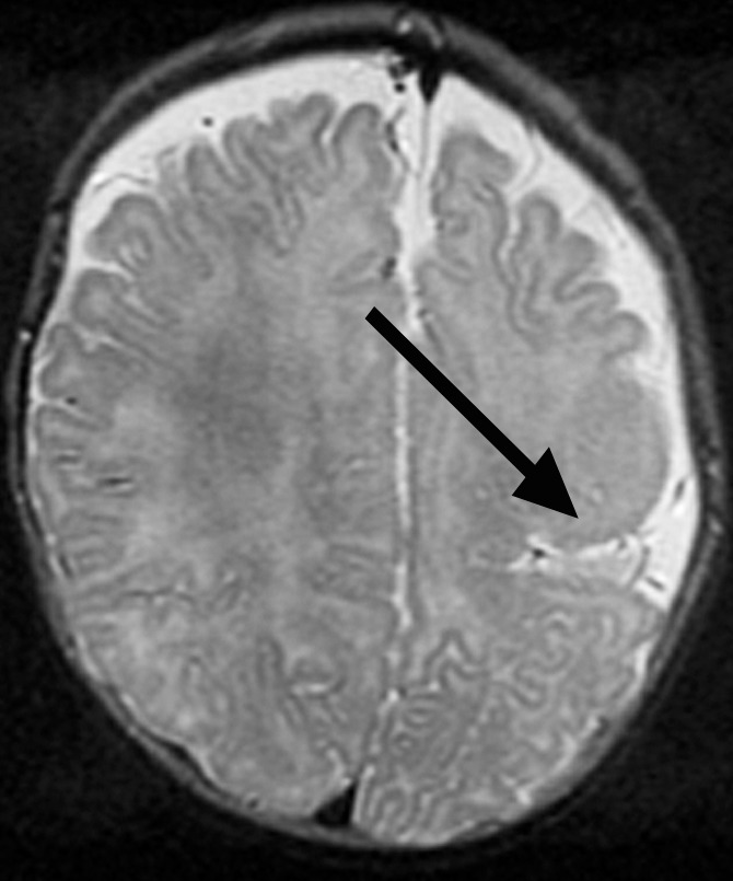 Figure 1c: