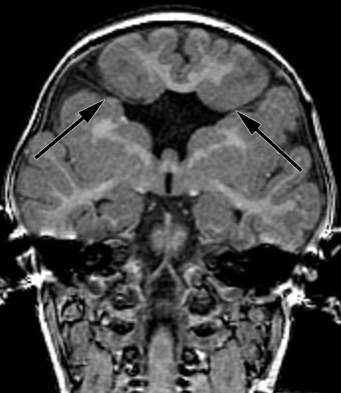 Figure 4b: