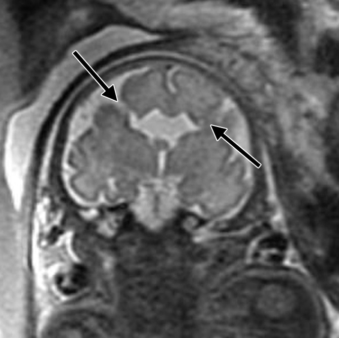 Figure 4a: