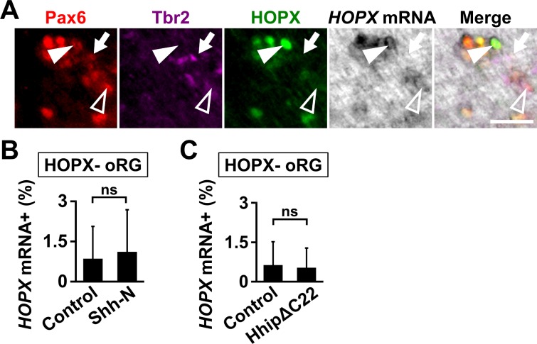 Figure 4—figure supplement 2.