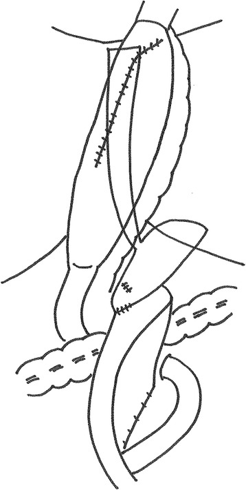 Fig. 4