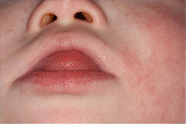 Fig. 6