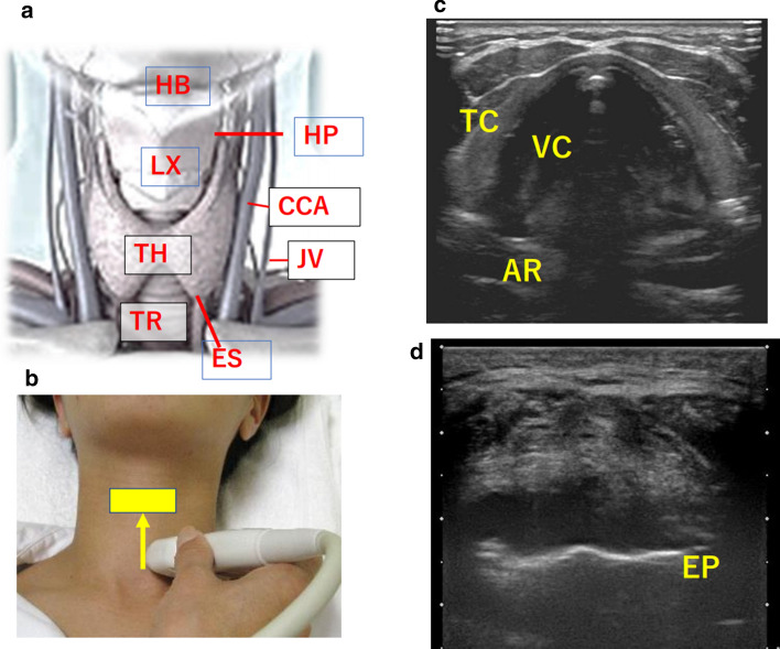 Fig. 2