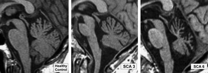 Fig 3.