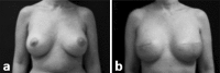 Fig. 12