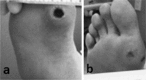 Fig. 11