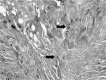 Fig. 13