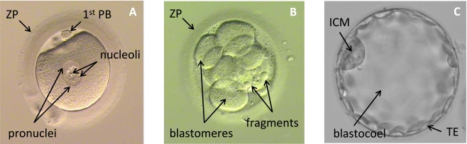 Fig. (1)