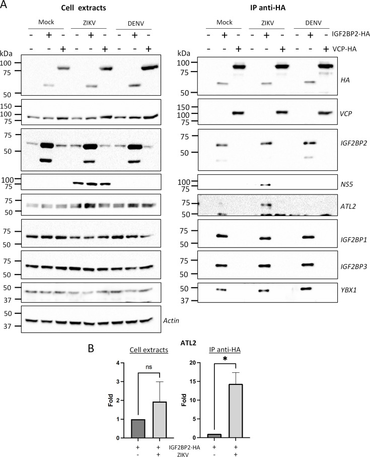 Figure 9—figure supplement 2.