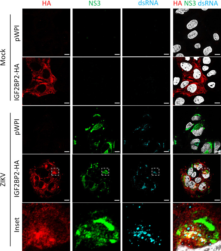 Figure 4—figure supplement 2.