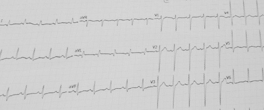 Figure 1a