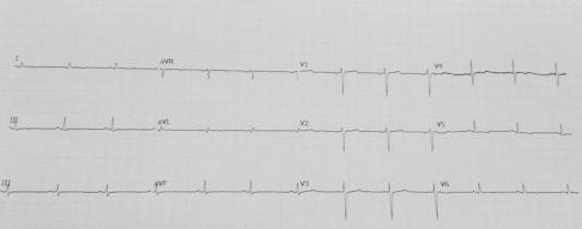 Figure 1b