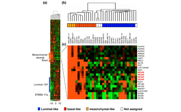 CD146 expression is associated with a poor prognosis in human breast ...