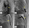Fig. 3