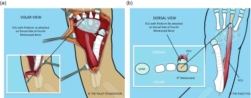 Figure 23.