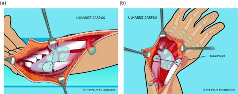 Figure 12.