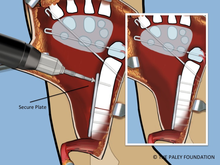 Figure 21.