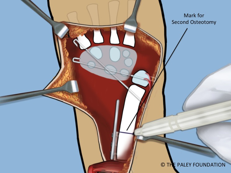 Figure 19.