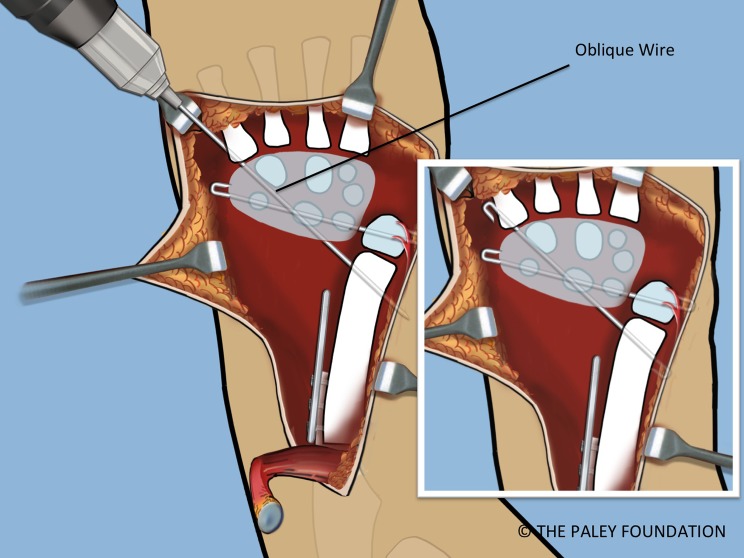 Figure 18.