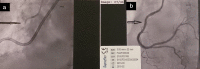 [Table/Fig-2a,b]: