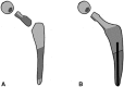Fig. 2A–B
