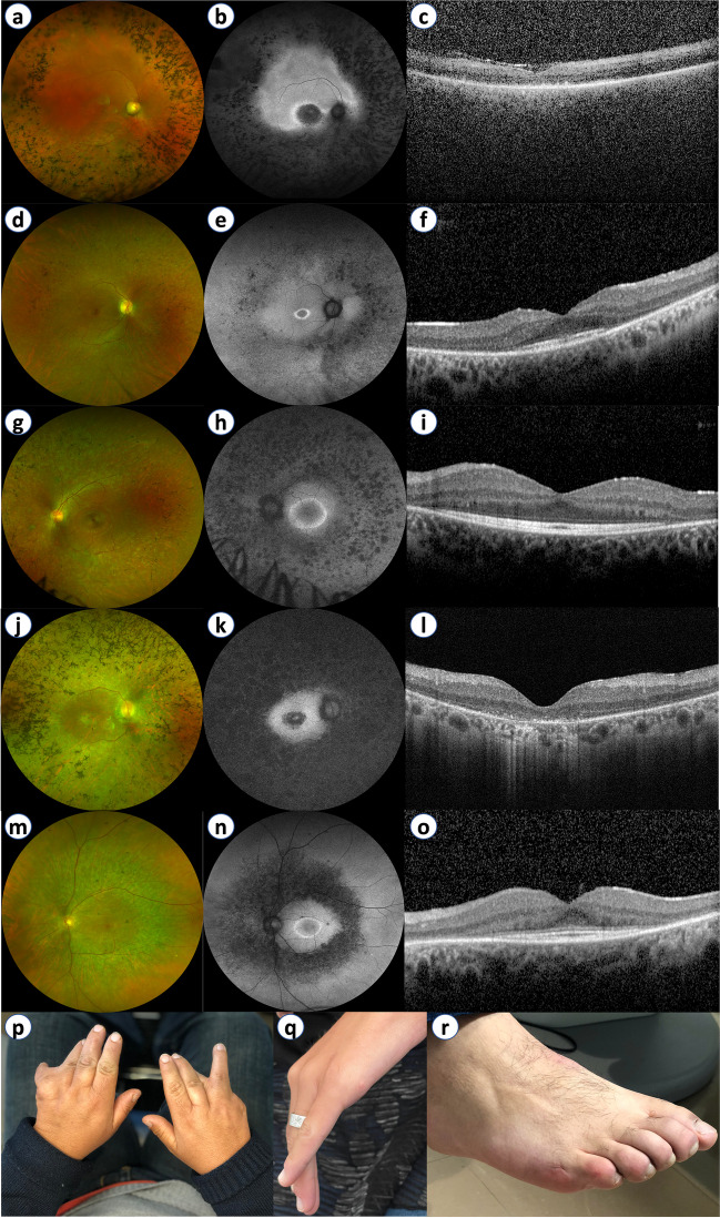 Fig. 4