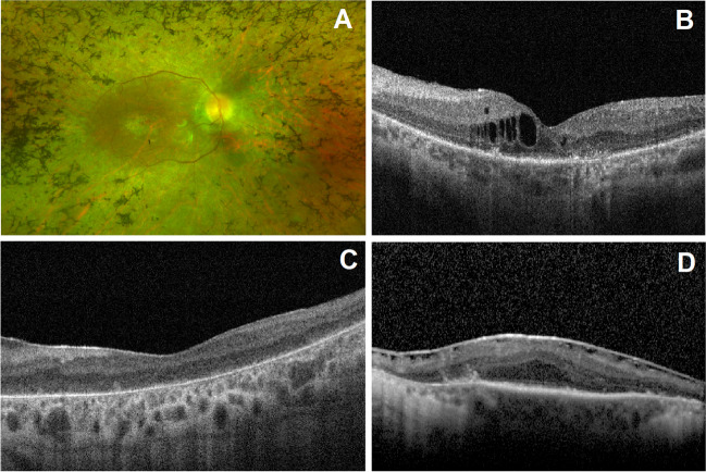 Fig. 3