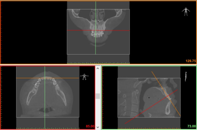 Fig. 4