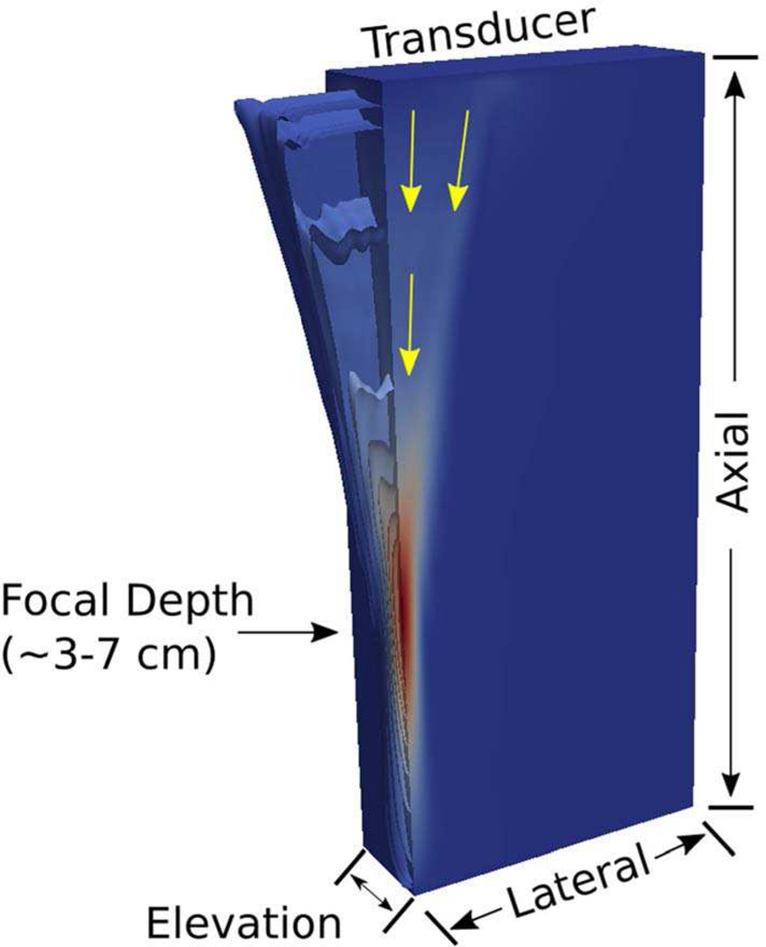 Fig. 2