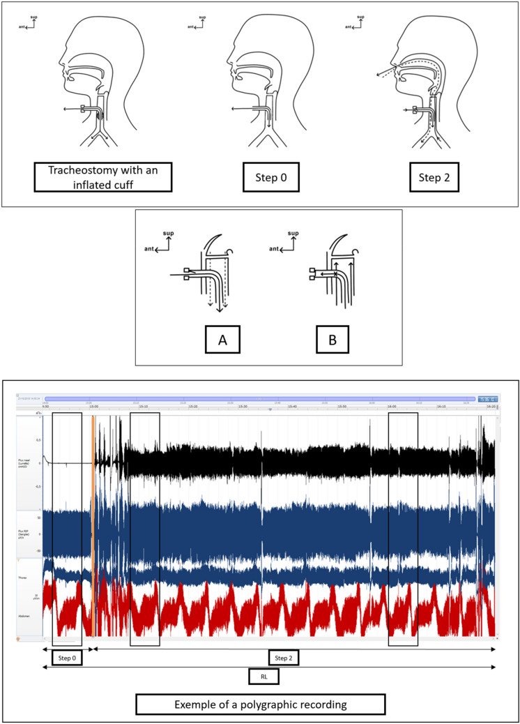 Fig. 1