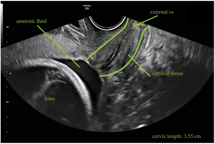 Figure 3.