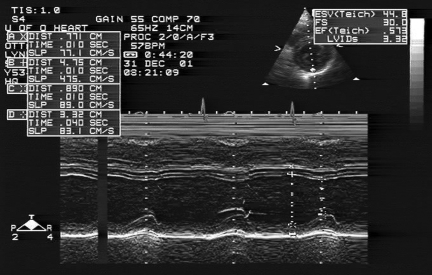 Figure 2)