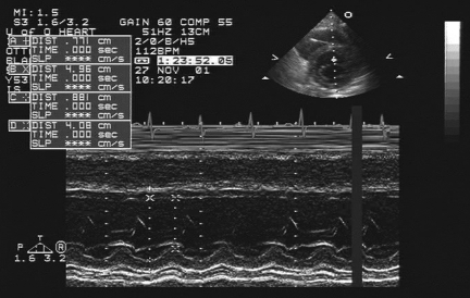 Figure 1)