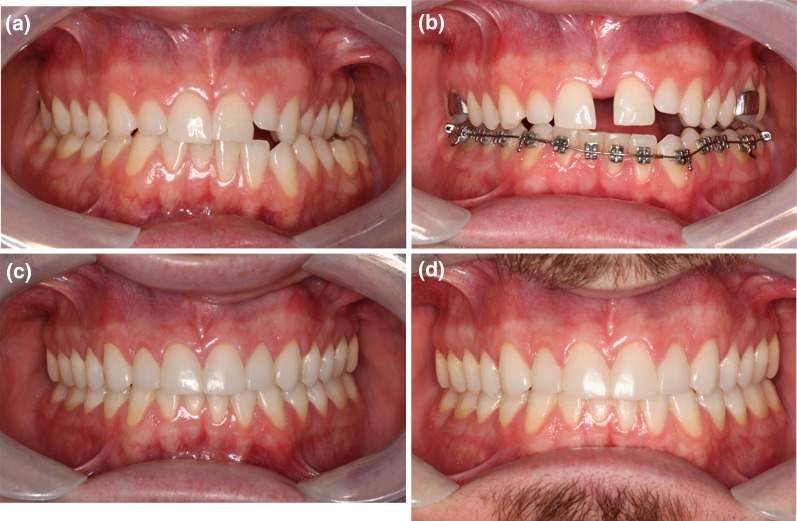 Fig. 3