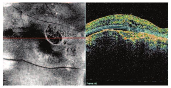 Figure 11