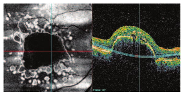 Figure 13