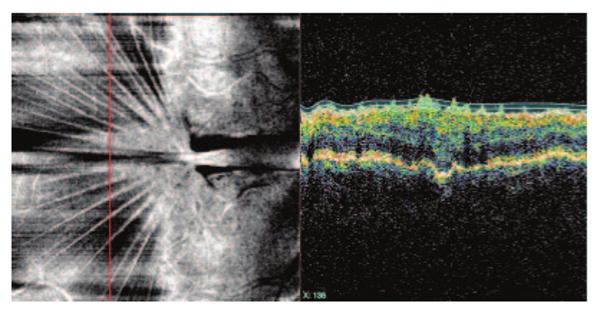 Figure 14