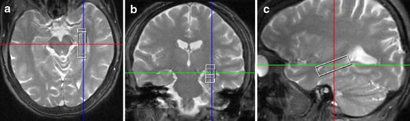 Fig. 1