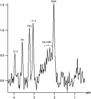 Fig. 2