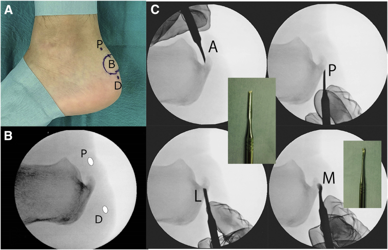 Fig 3