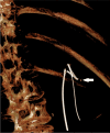 Fig. 3.