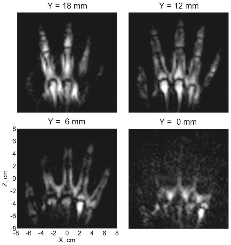 Fig. 3