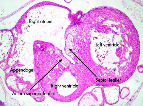 Figure 14