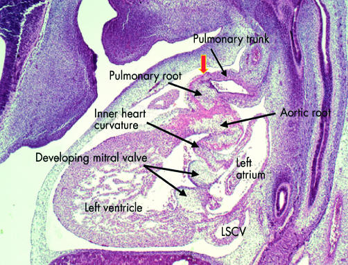 Figure 17