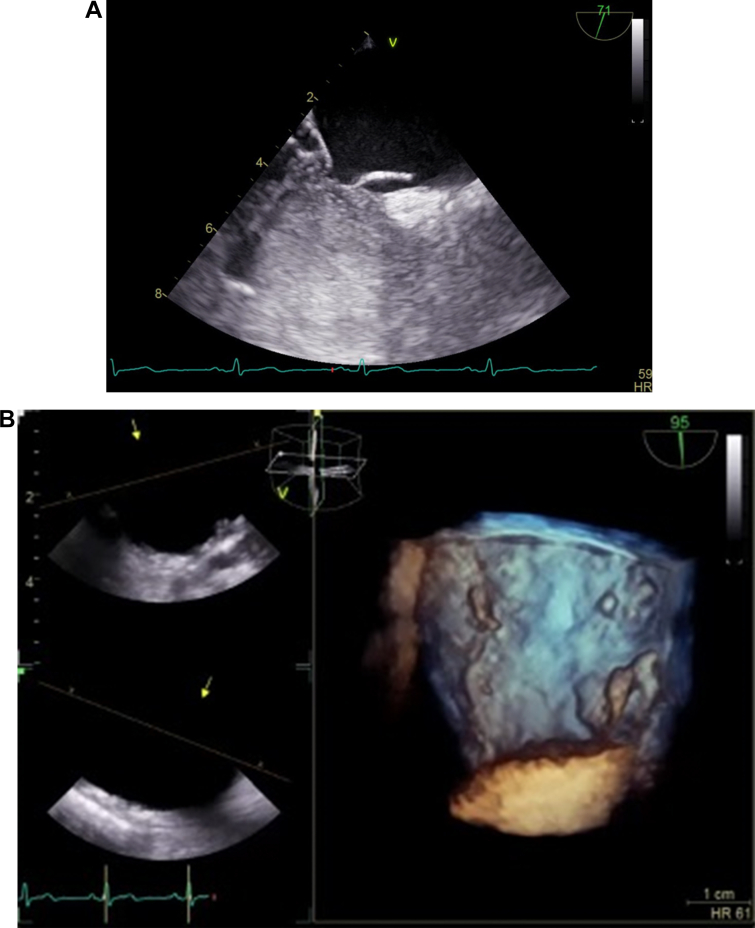 Figure 3