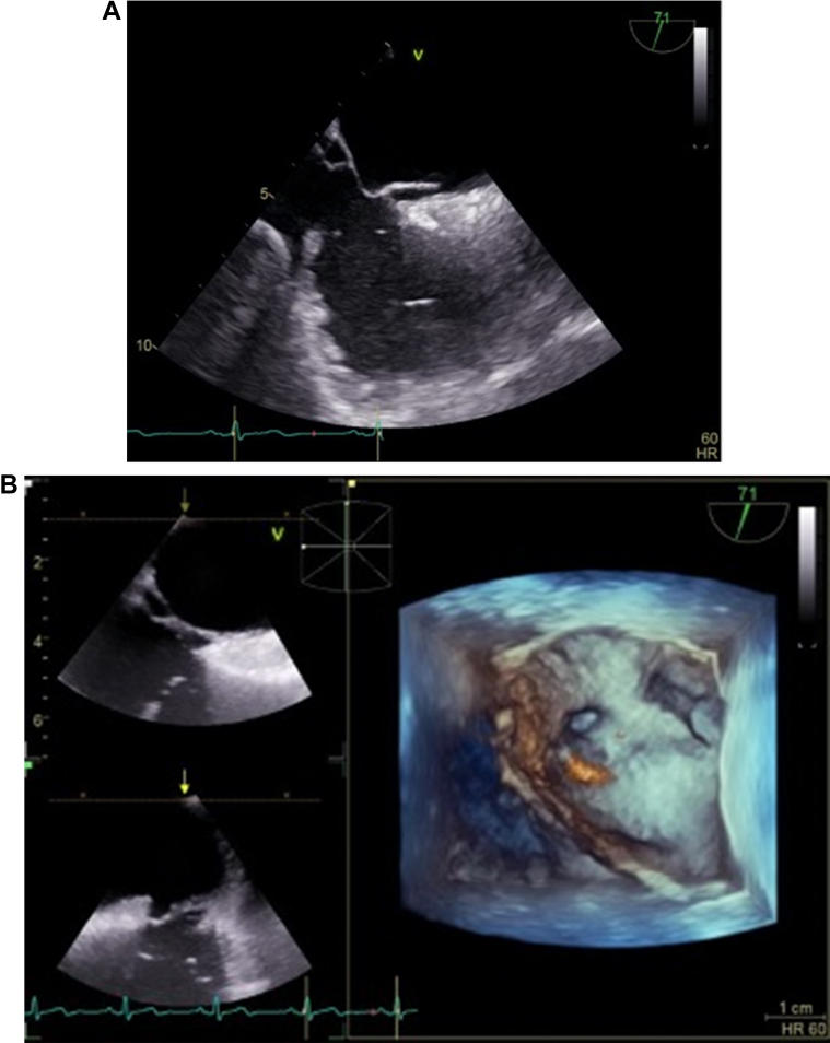 Figure 2