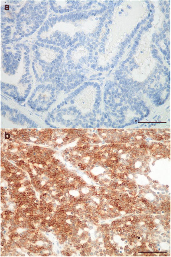 Bcl-2 expression and prognostic significance in feline invasive mammary ...